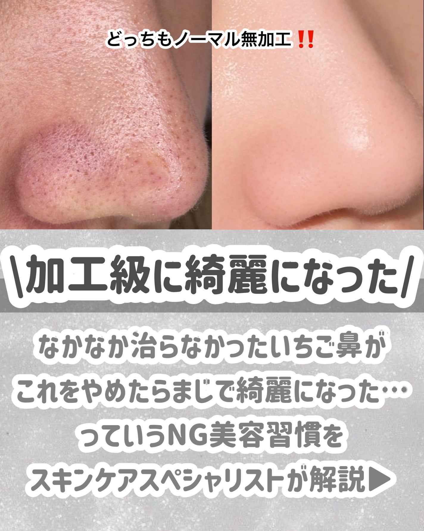 ミセラークレンジングシート セラムモイスト/ビフェスタ/クレンジングシートを使ったクチコミ(2枚目)