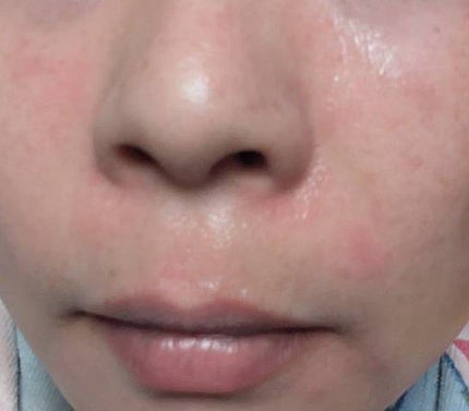 プロバイオダーム コラーゲン リモデリングクリーム/BIOHEAL BOH/フェイスクリームを使ったクチコミ(3枚目)