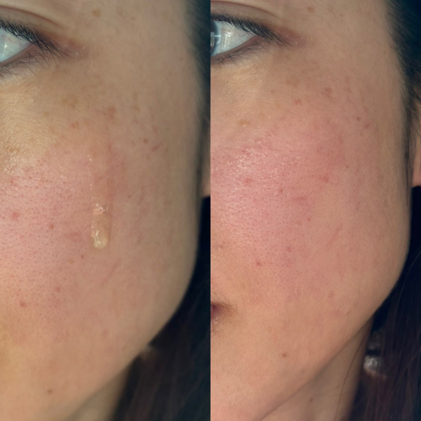 PDRNグロウセラム4.0ポンプ/Abib /美容液を使ったクチコミ(4枚目)