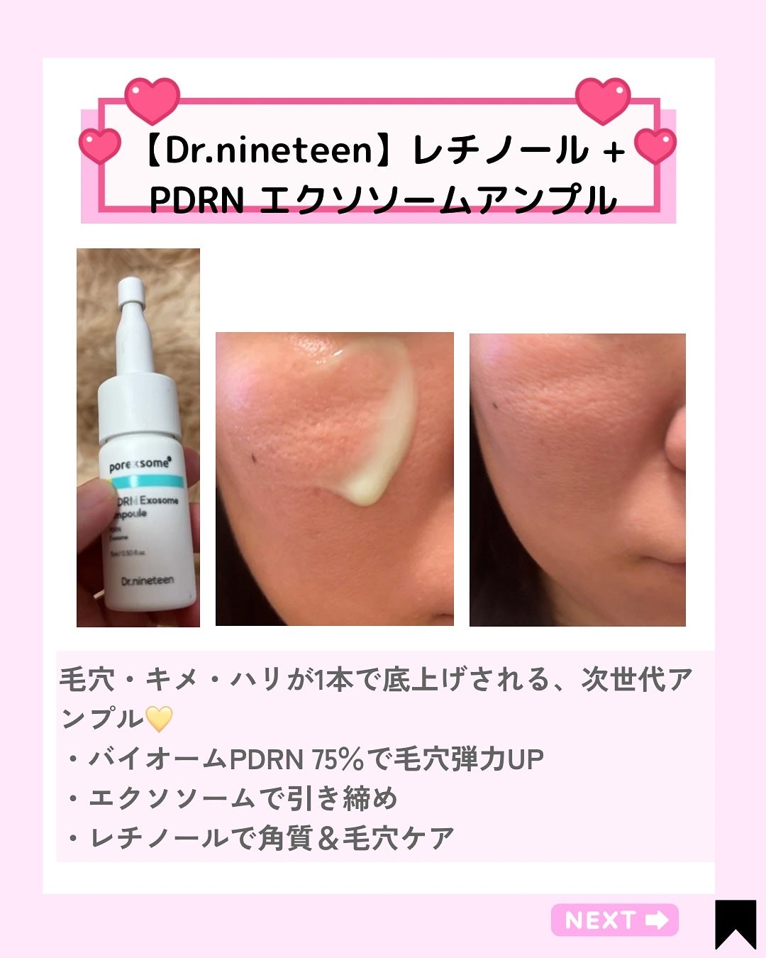 Kana on LIPS 「今週使ってよかった"毛穴・水分・透明感ケア"神アイテム3選まと..」(2枚目)