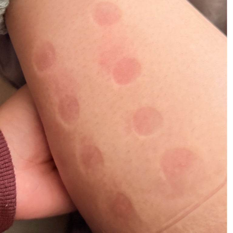 ゴリラのふたつかみ GRM-2501/ドウシシャ/その他フィットネスを使ったクチコミ(6枚目)