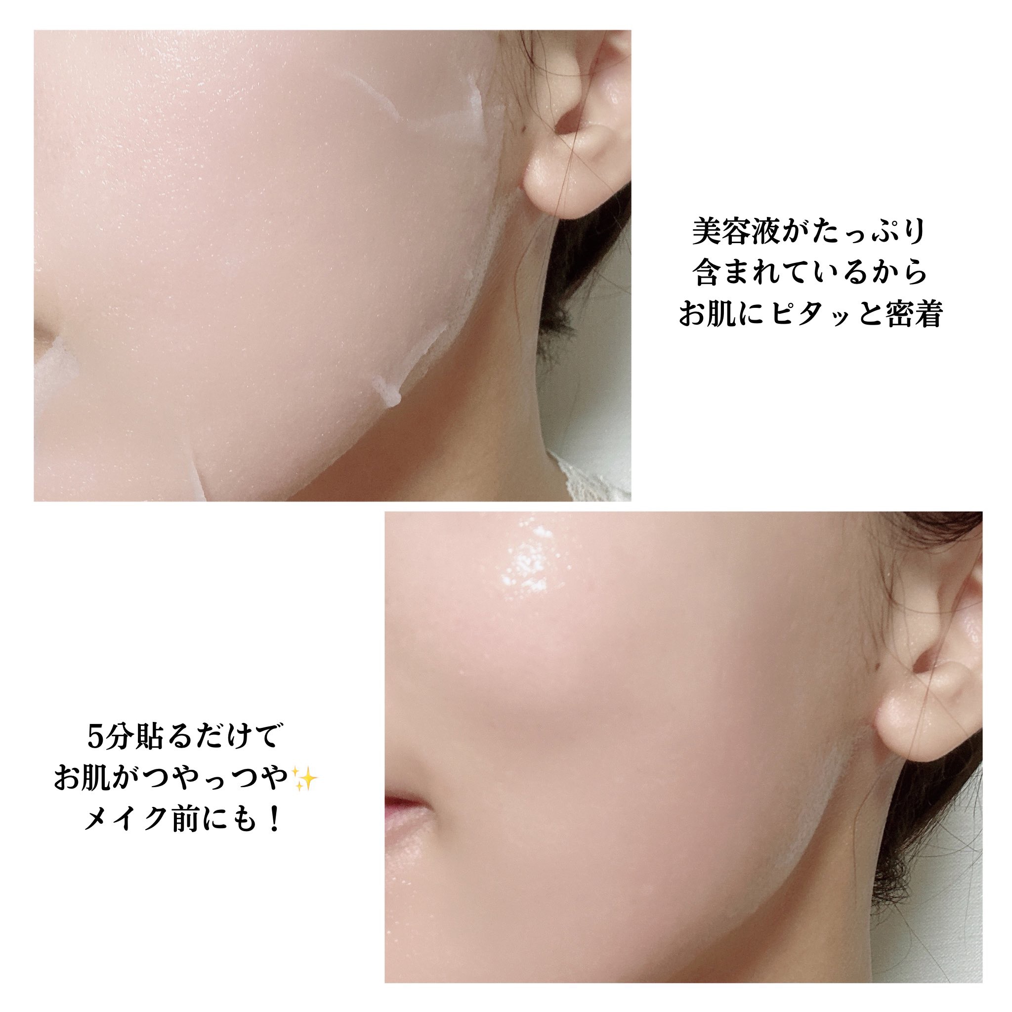 PDRN リフティングマスク/MEDIHEAL/シートマスク・パックを使ったクチコミ（3枚目）