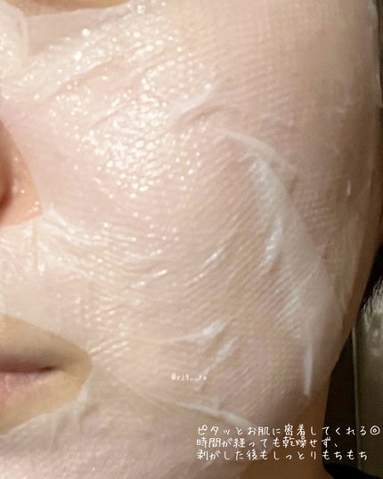 トラブルパッチマスク/EIOM/その他スキンケアを使ったクチコミ(3枚目)