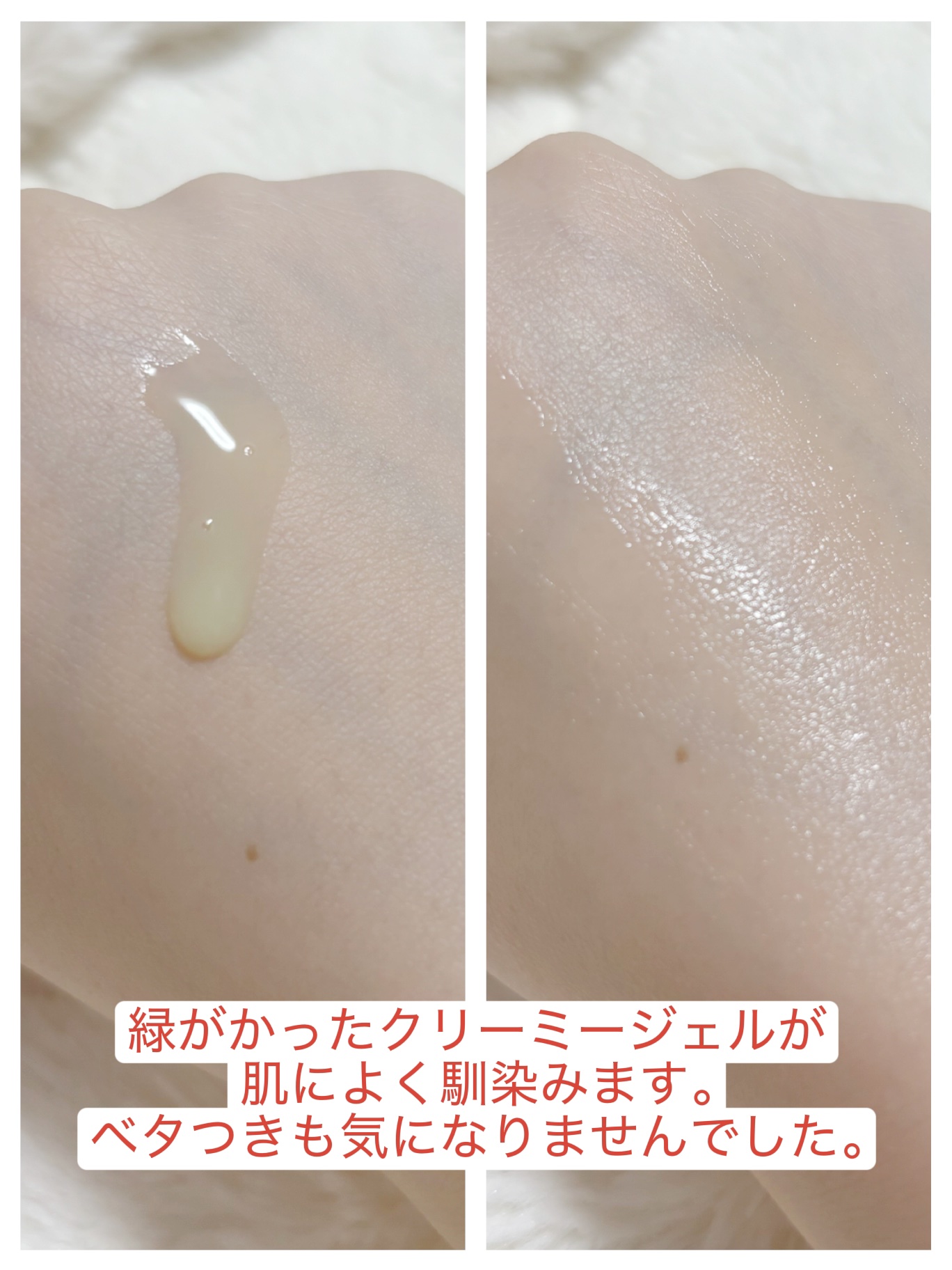 PDRNエキスパートテンションターゲットセラム/SAM'U/美容液を使ったクチコミ（2枚目）