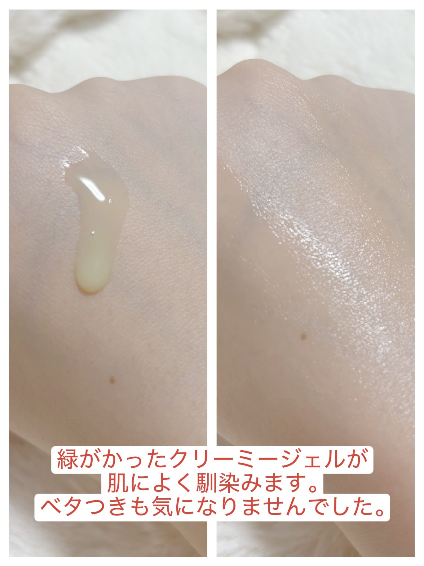 PDRNエキスパートテンションターゲットセラム/SAM'U/美容液を使ったクチコミ(2枚目)