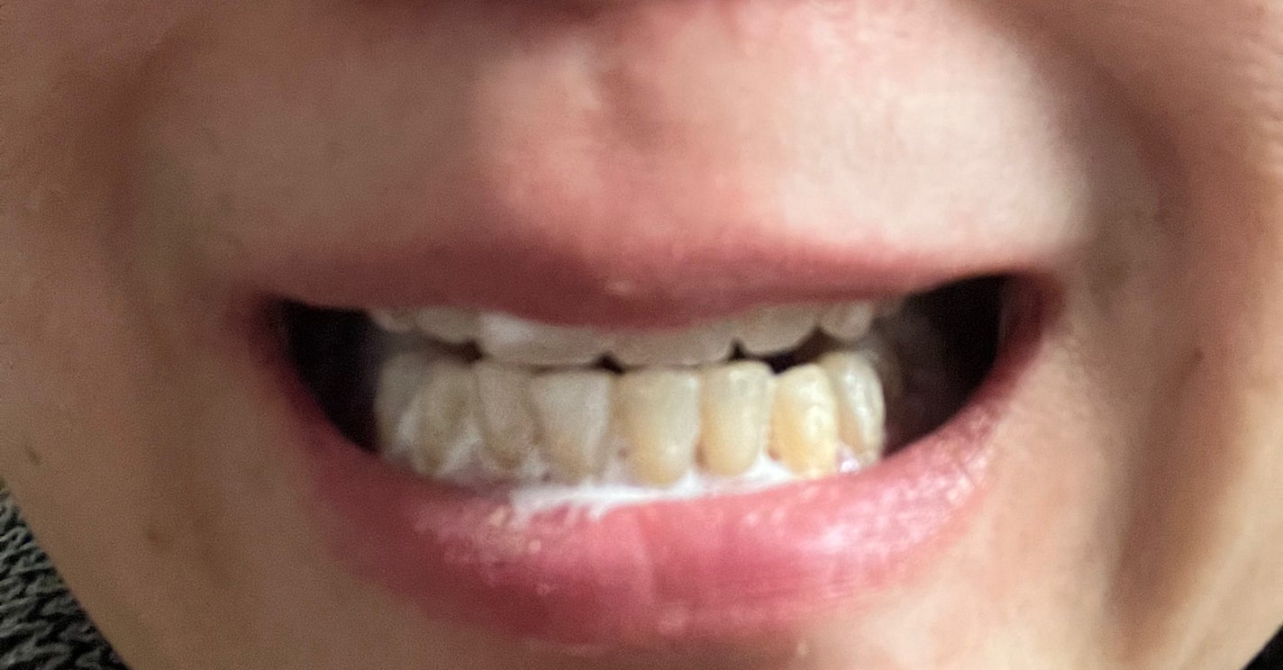 ピュオーラ 炭酸ハミガキ【医薬部外品】/ピュオーラ/歯磨き粉を使ったクチコミ(6枚目)