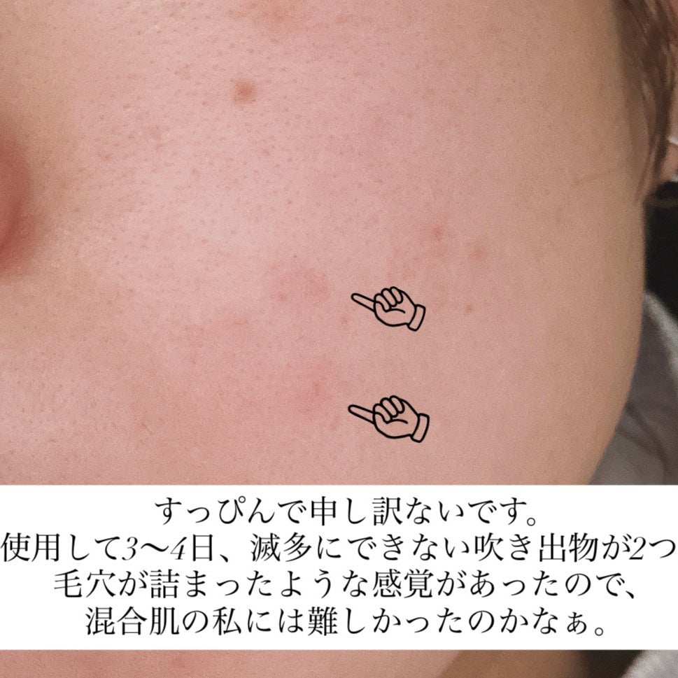 セラム シールド/ONE BY KOSE/フェイスバームを使ったクチコミ(4枚目)