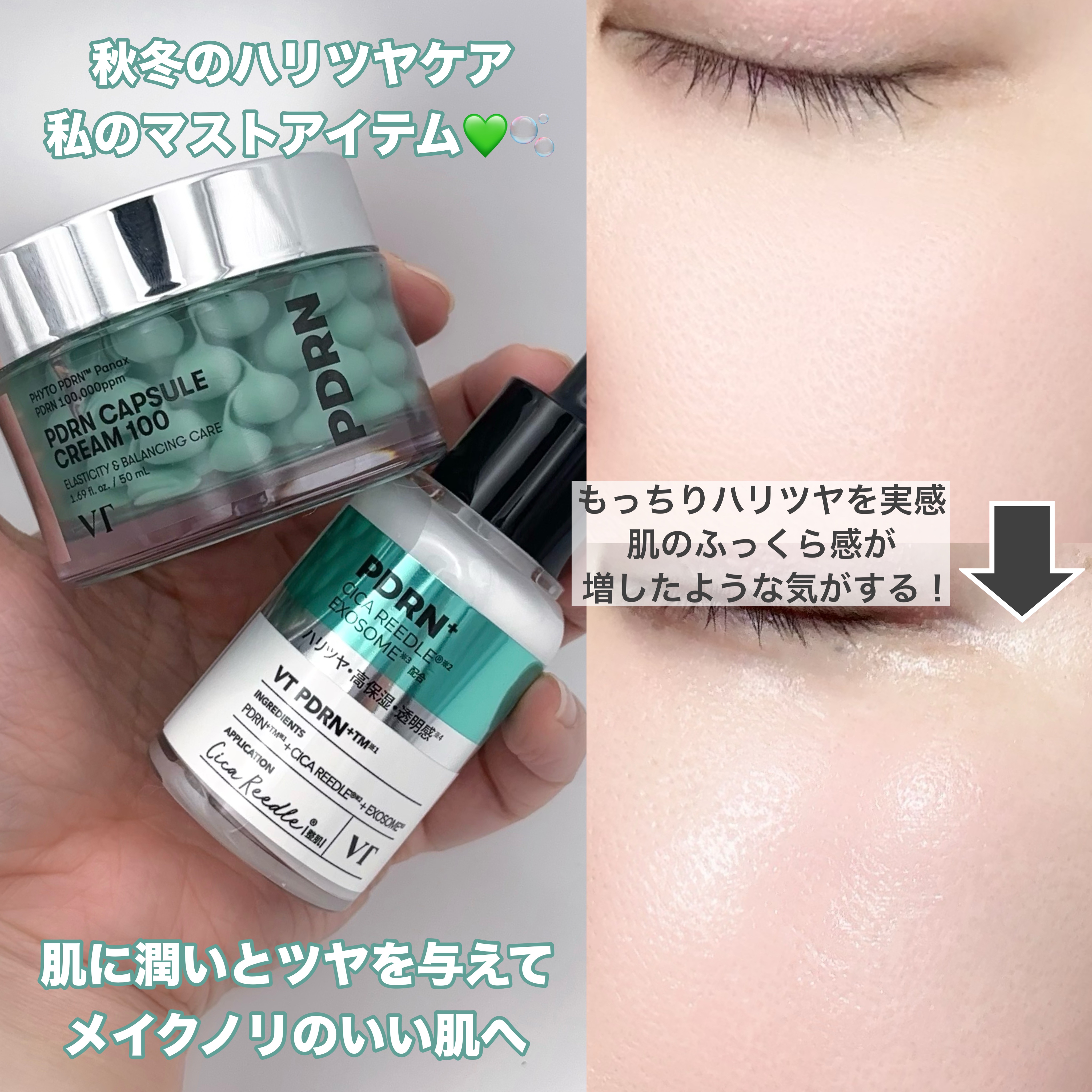 リードルS PDRN+ セラム/VT/美容液を使ったクチコミ（2枚目）