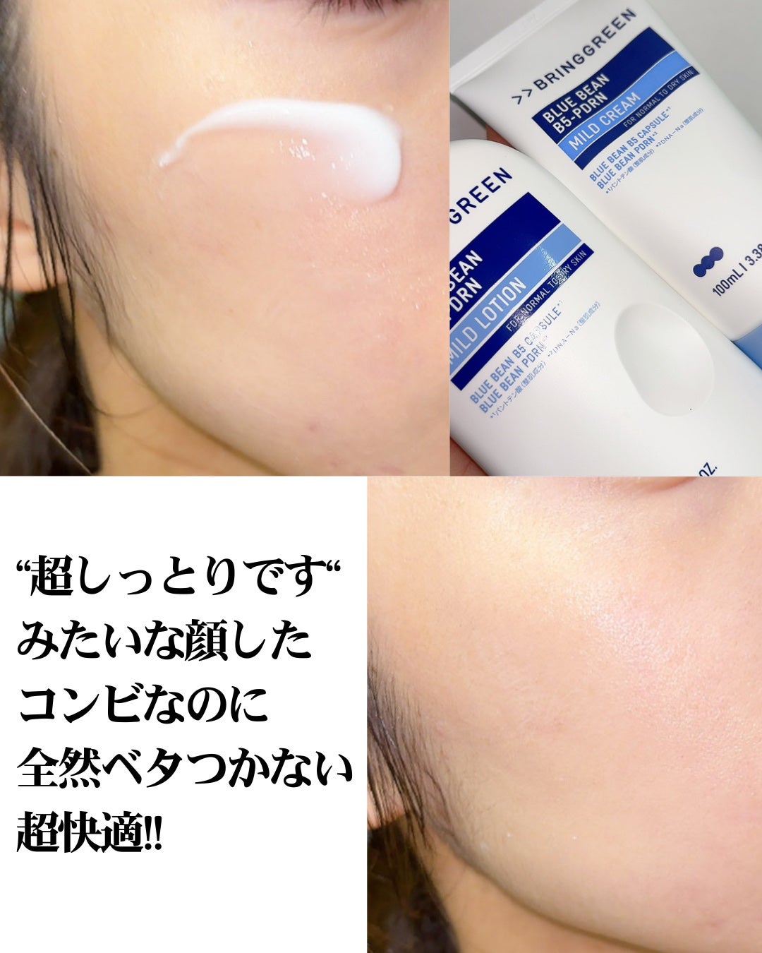 ブルービーンB5-PDRN™マイルドローション/BRING GREEN/乳液を使ったクチコミ(7枚目)