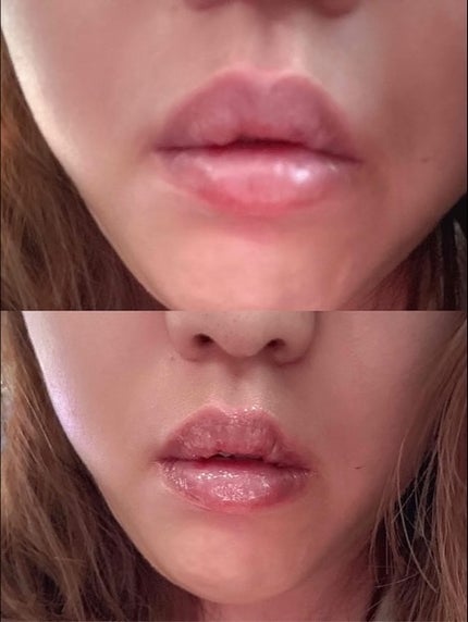 ソリッドイン リップエッセンス/Torriden/リップ美容液を使ったクチコミ(5枚目)