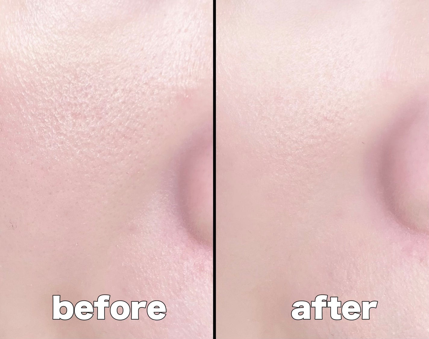 ディオールスキン フォーエヴァー フルイド グロウ/Dior/リキッドファンデーションを使ったクチコミ(2枚目)