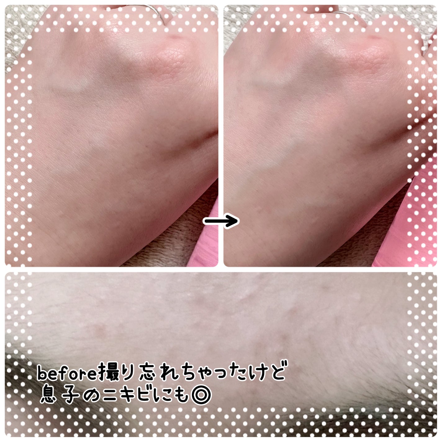 AZケア トナー/VT/化粧水を使ったクチコミ(4枚目)