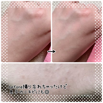 AZケア トナー/VT/化粧水を使ったクチコミ(4枚目)