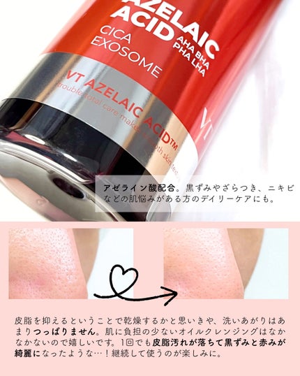 AZケア クレンジングオイル/VT/オイルクレンジングを使ったクチコミ(3枚目)