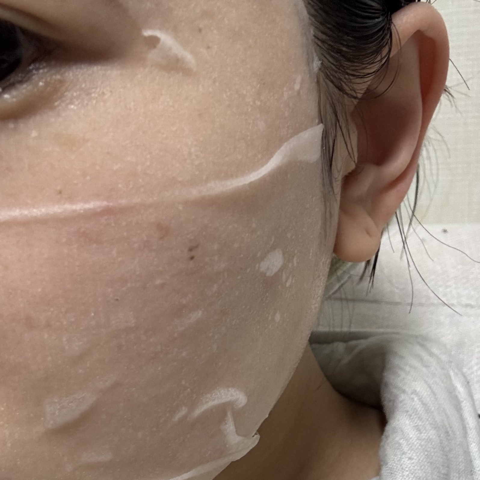 ドクダミシートマスクデイリーピック/Abib /シートマスク・パックを使ったクチコミ（3枚目）