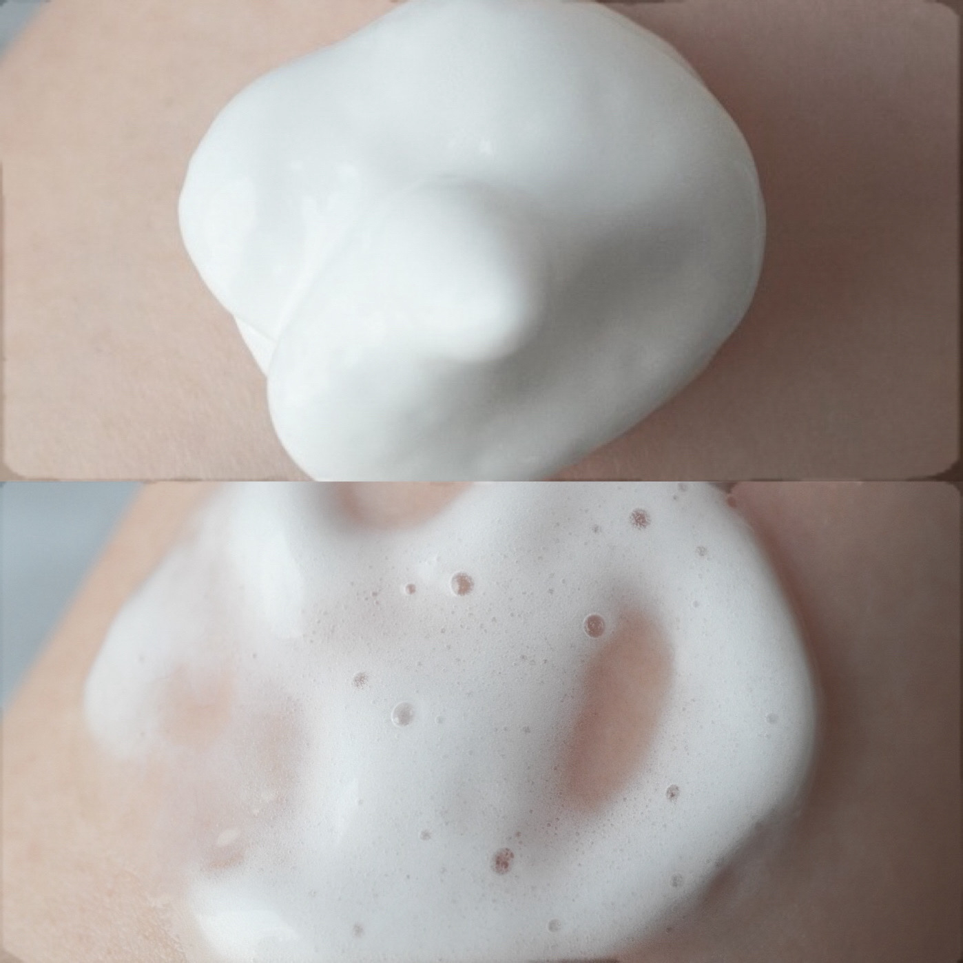 キュレル 潤浸保湿 泡美容液 【医薬部外品】/キュレル/美容液を使ったクチコミ（2枚目）