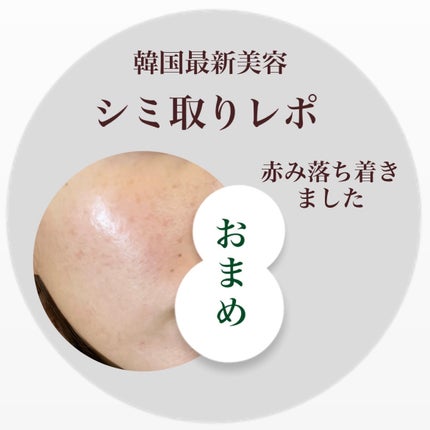 LAVA LAVA×BE-MAX Liposome-C+のクチコミ「LAVA LAVA×BE-MAX Liposome-C+
キズパワーパッドを剥がして
2.....」(1枚目)