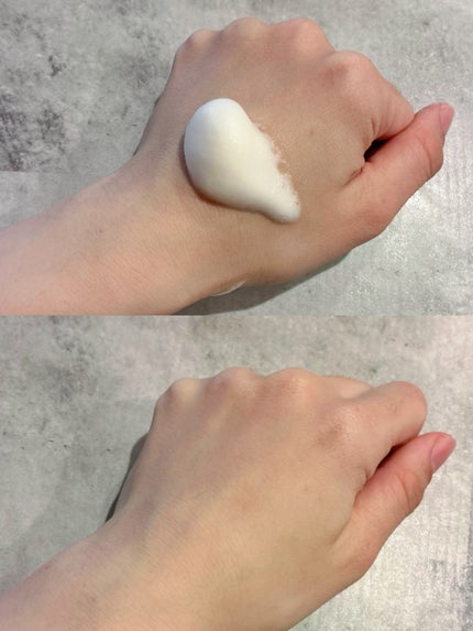 ABC-Gピールウォッシュ/ドクターケイ/泡洗顔を使ったクチコミ(3枚目)