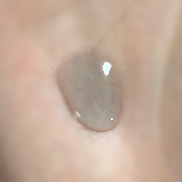 ブラックPDRN 美容液/ネイチャーリパブリック/美容液を使ったクチコミ（2枚目）