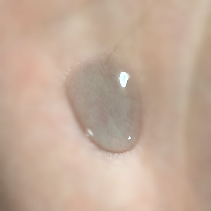 ãã©ãã¯PDRN çŸå®¹æ¶²/ãã€ãã£ãŒãªãããªãã¯/çŸå®¹æ¶²ã䜿ã£ãã¯ãã³ãïŒ2æç®ïŒ