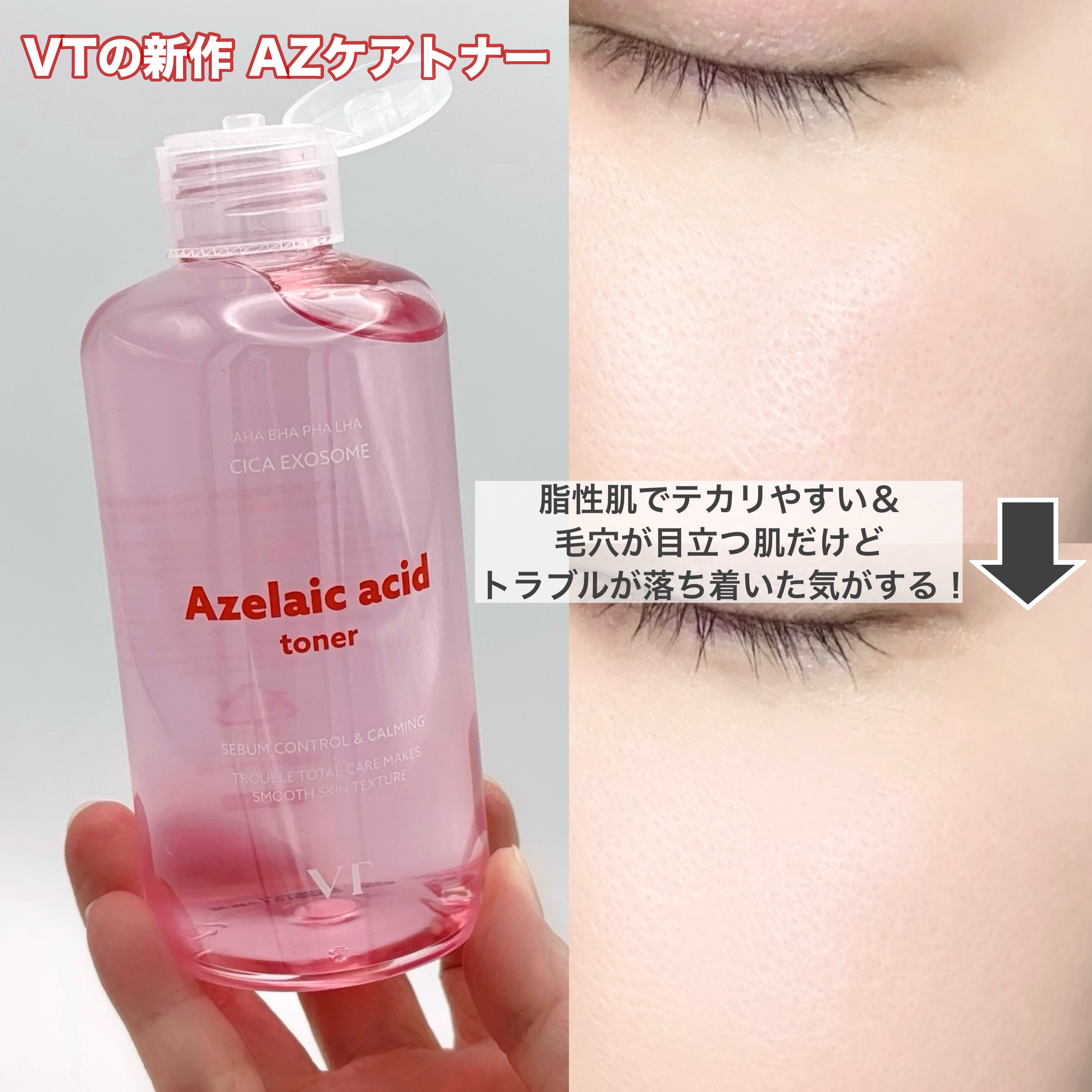 AZケア トナー/VT/化粧水を使ったクチコミ（3枚目）