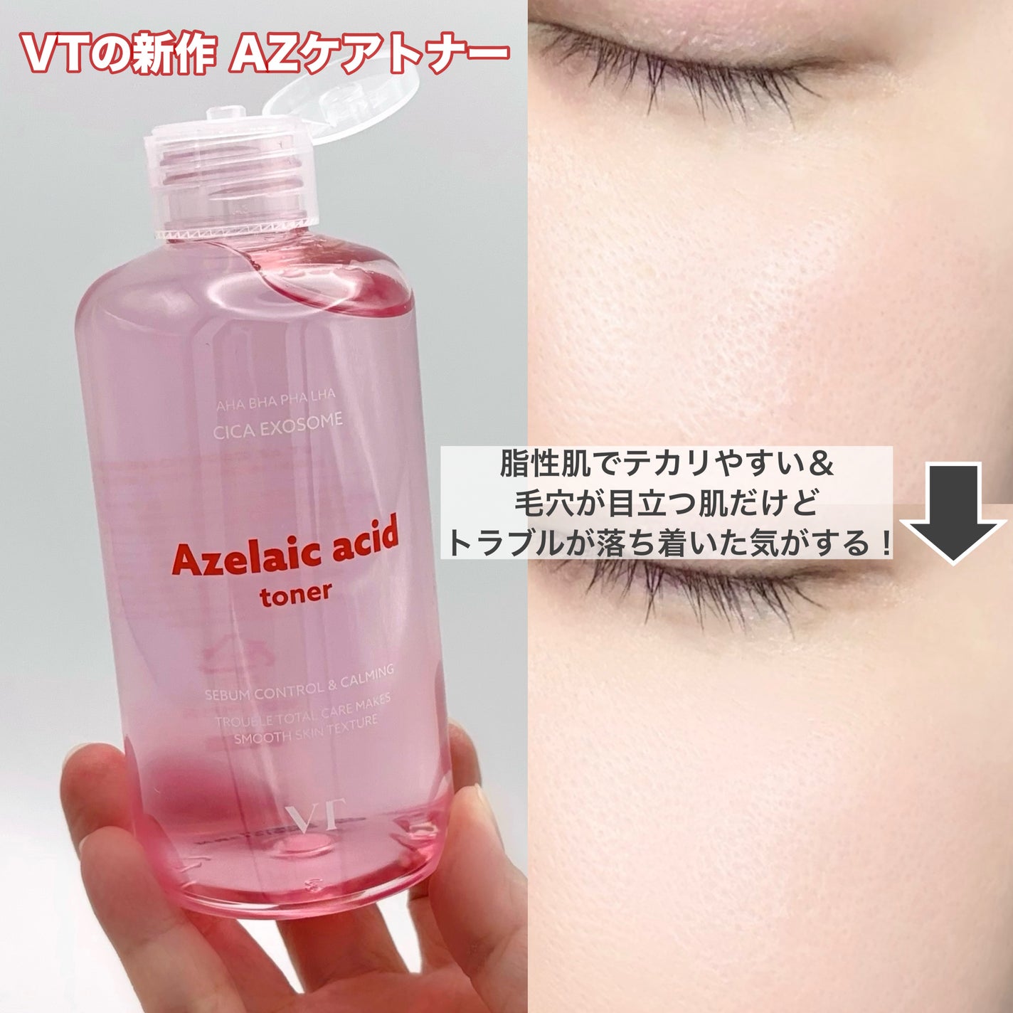 AZケア トナー/VT/化粧水を使ったクチコミ(3枚目)