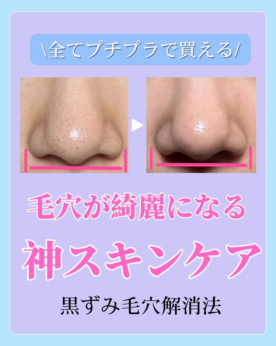 薬用 しみ 集中対策 美容液/メラノCC/美容液を使ったクチコミ（1枚目）