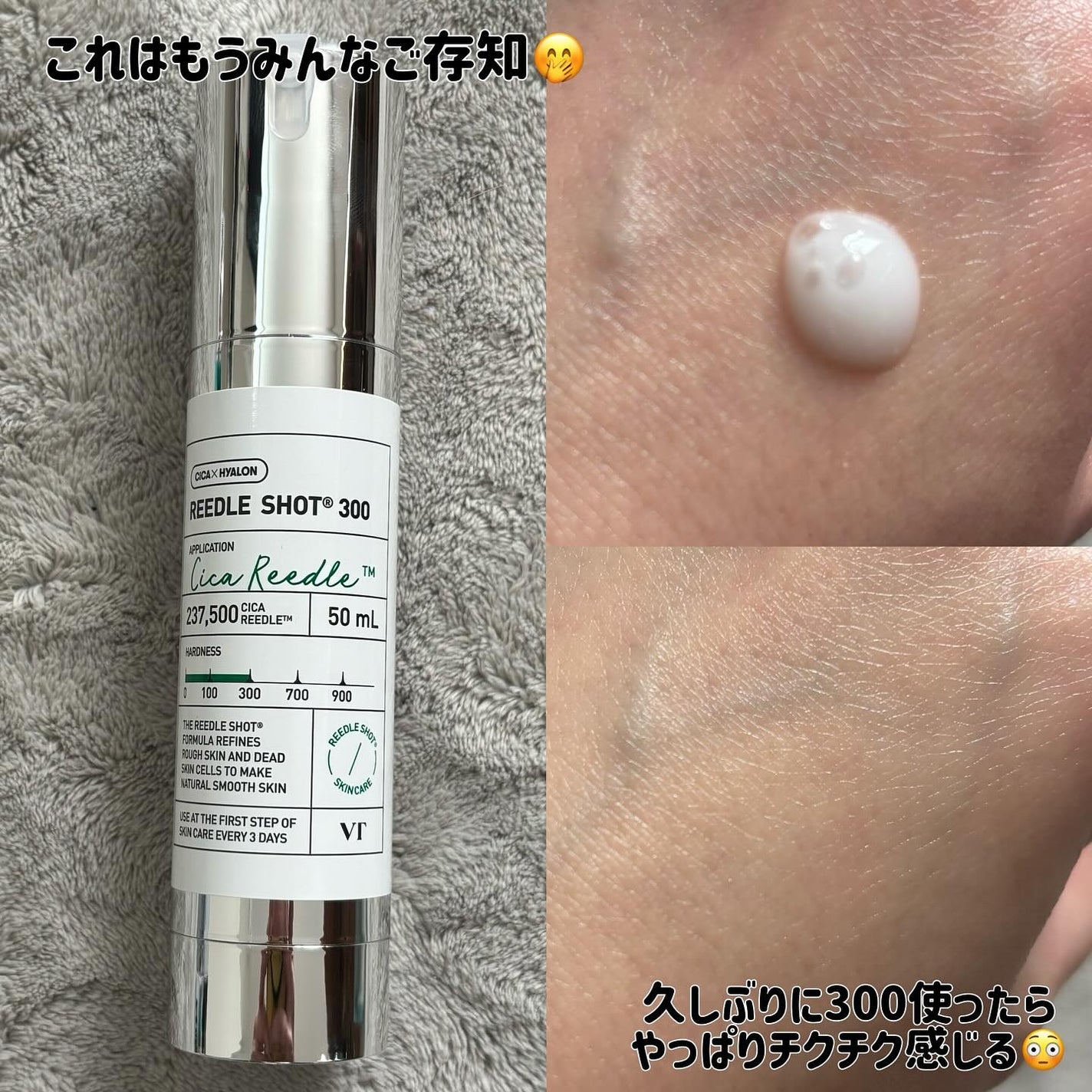 __akk1990 on LIPS 「✔︎VT VT肌悩みニャンでもおまかせセット PDRNツヤ発光..」(5枚目)