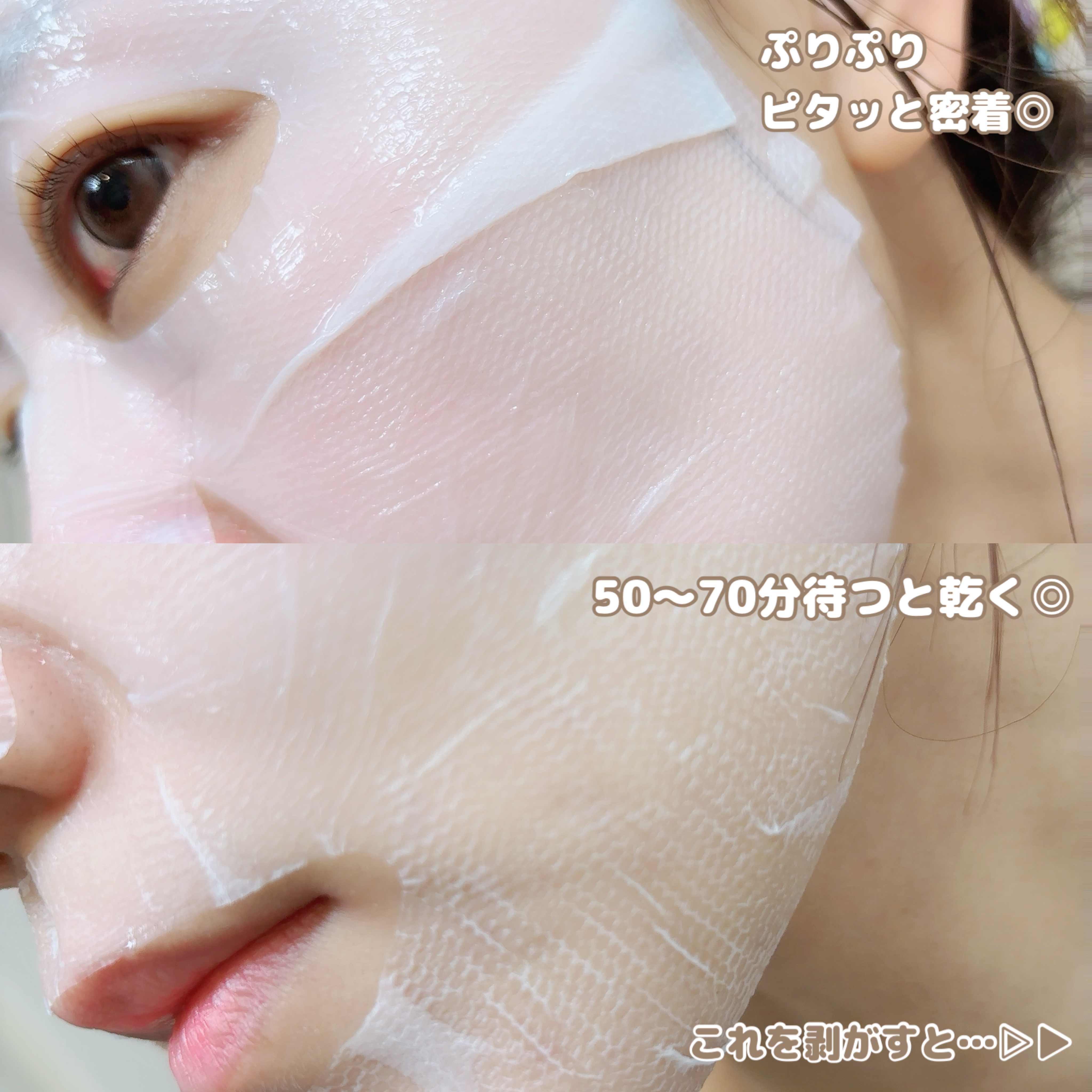 トラブルパッチマスク/EIOM/その他スキンケアを使ったクチコミ（3枚目）