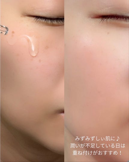 トラブルターゲティングセラム/EIOM/美容液を使ったクチコミ(8枚目)