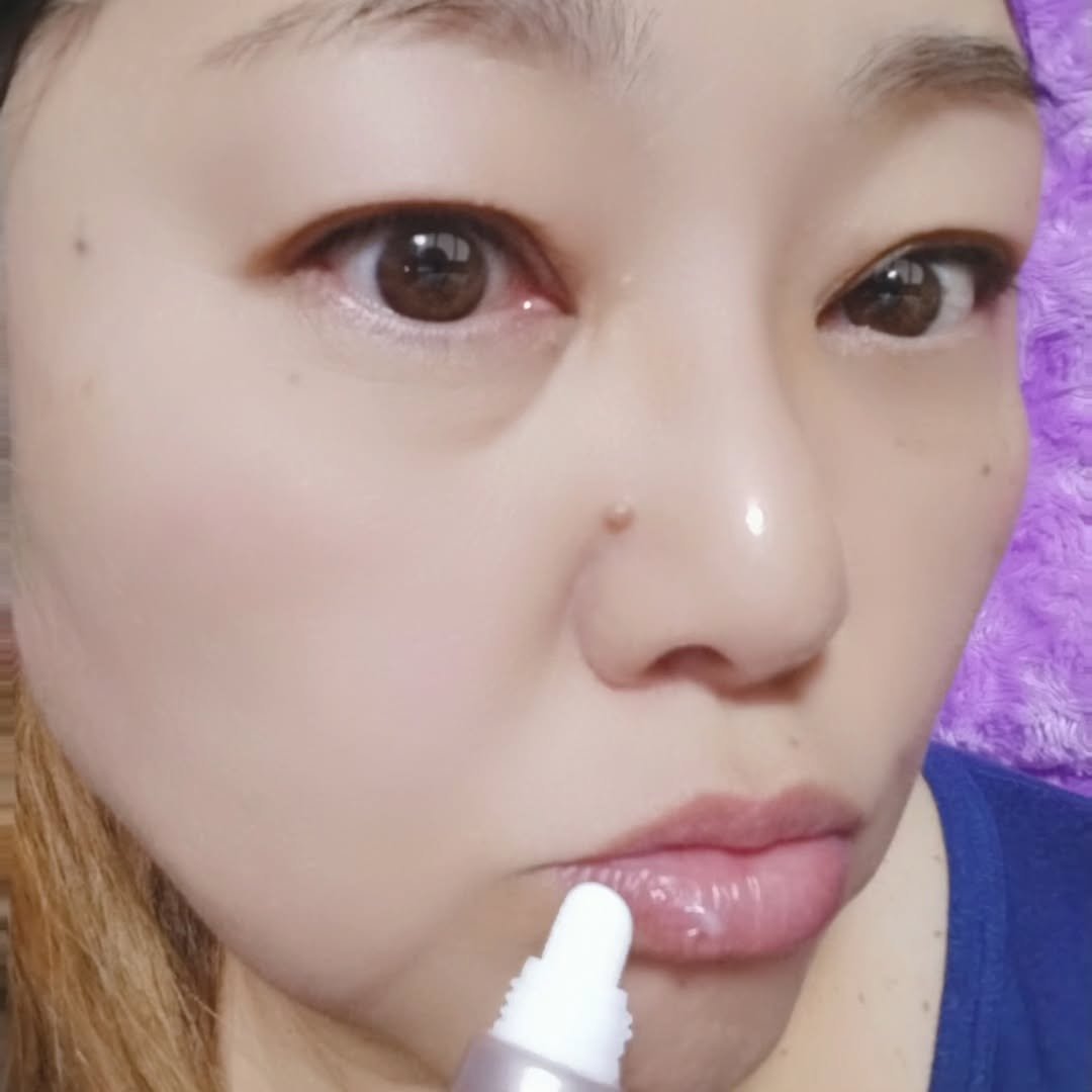 ナイトニードルリップ　ディープモイスト/CHOOSY/リップ美容液を使ったクチコミ（1枚目）