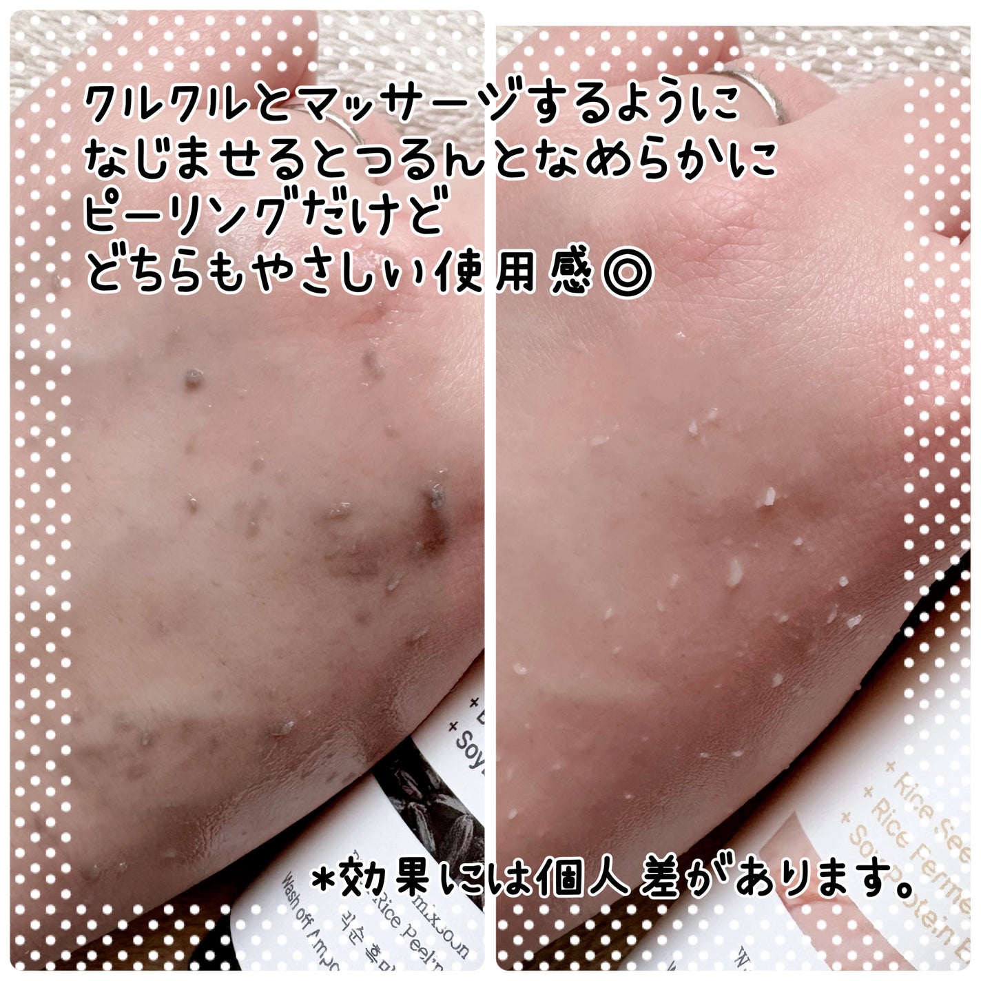 NekoðŸ on LIPS ãæè¿ä¹Ÿç¥ã«ããããã¿ãèã®ã¶ã©ã€ããæ°ã«ãªããããmixsoo..ãïŒ4æç®ïŒ