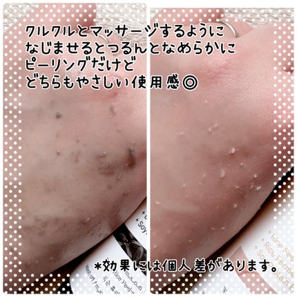 NekoðŸ on LIPS ãæè¿ä¹Ÿç¥ã«ããããã¿ãèã®ã¶ã©ã€ããæ°ã«ãªããããmixsoo..ãïŒ4æç®ïŒ