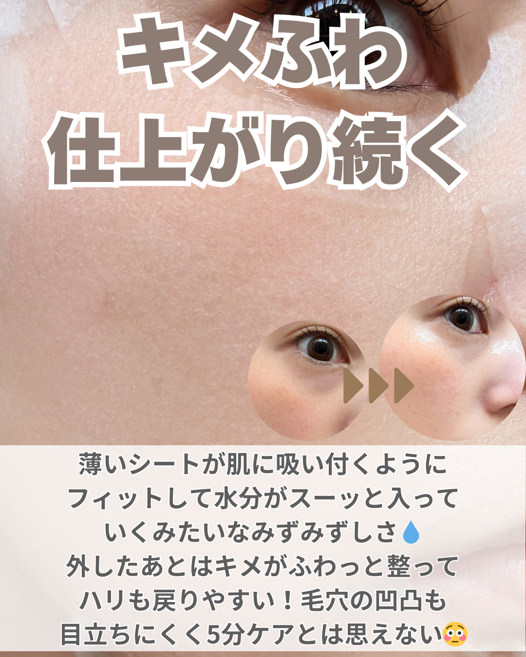 PDRN リフティングマスク/MEDIHEAL/シートマスク・パックを使ったクチコミ（3枚目）