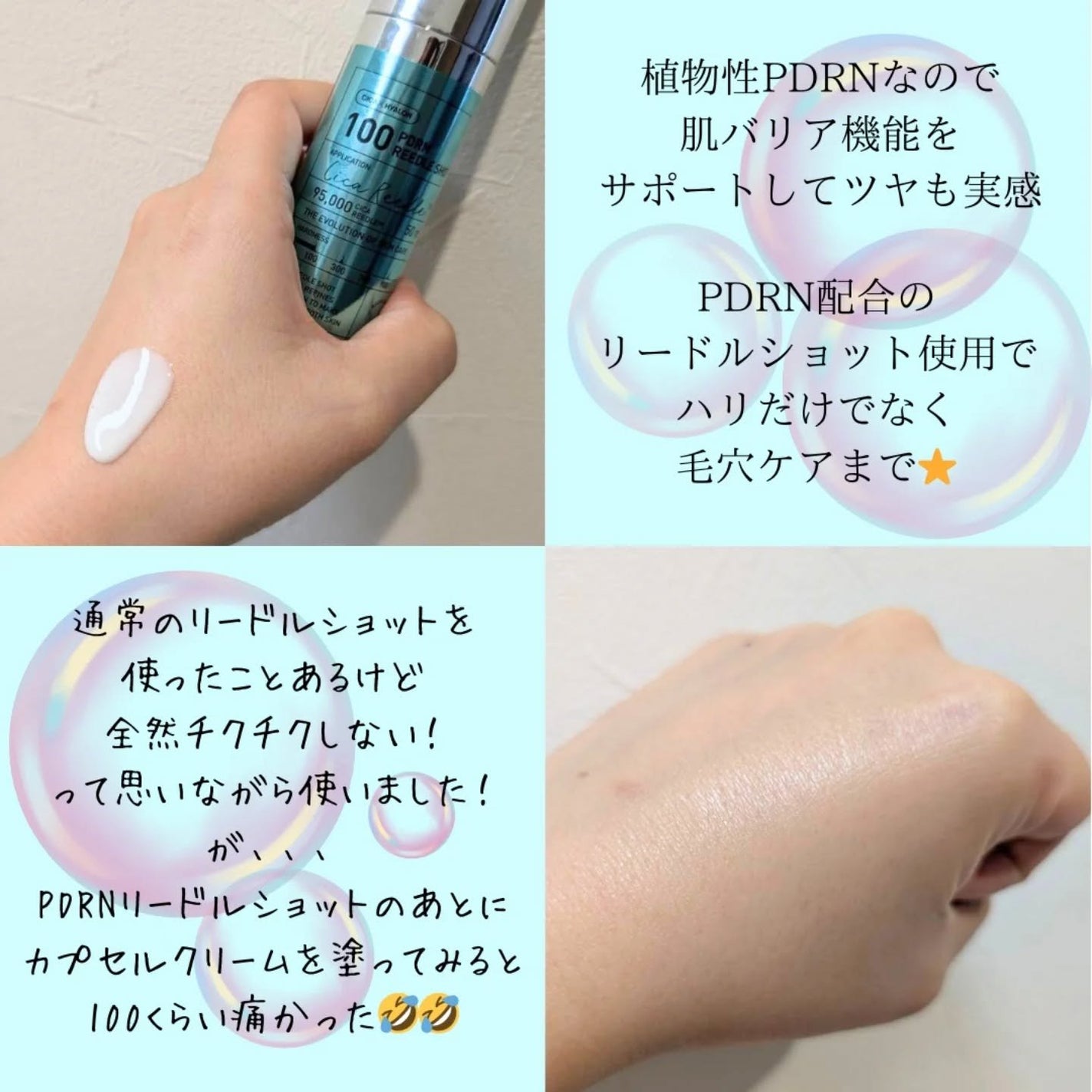ぼんどまん on LIPS 「VTさま【PDRNカプセルクリーム PDRNリードルショット】..」(2枚目)