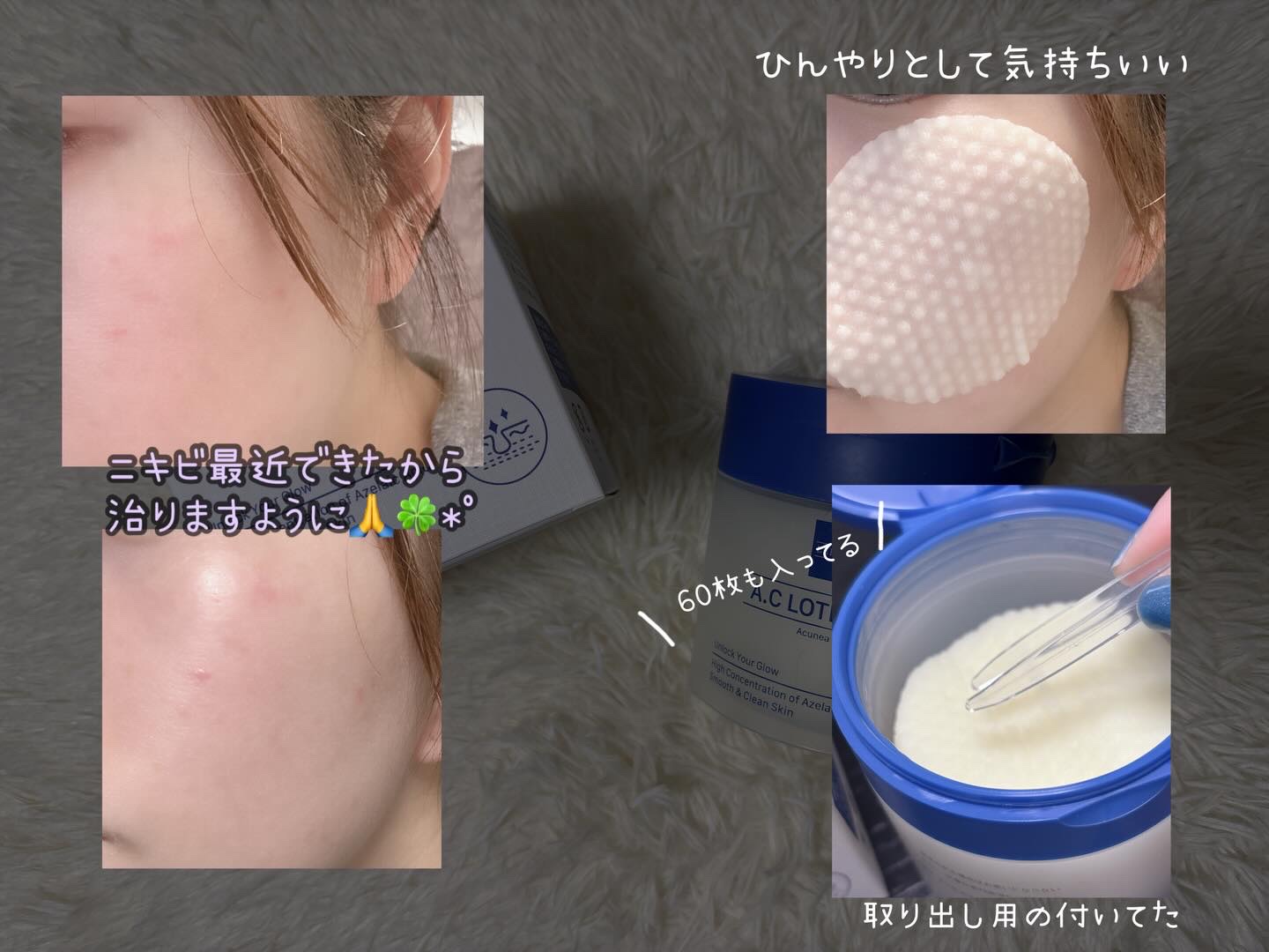 アゼライン酸 トナーパッド/LEPOREM/トナーパッドを使ったクチコミ（3枚目）