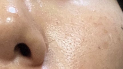 トリートメントローション(ブライトニング)しっとり 本体/アクアレーベル/化粧水を使ったクチコミ(2枚目)