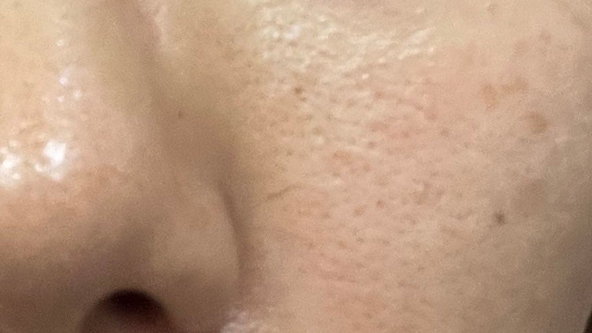 バランシングGAローション/TOUT VERT/化粧水を使ったクチコミ(1枚目)