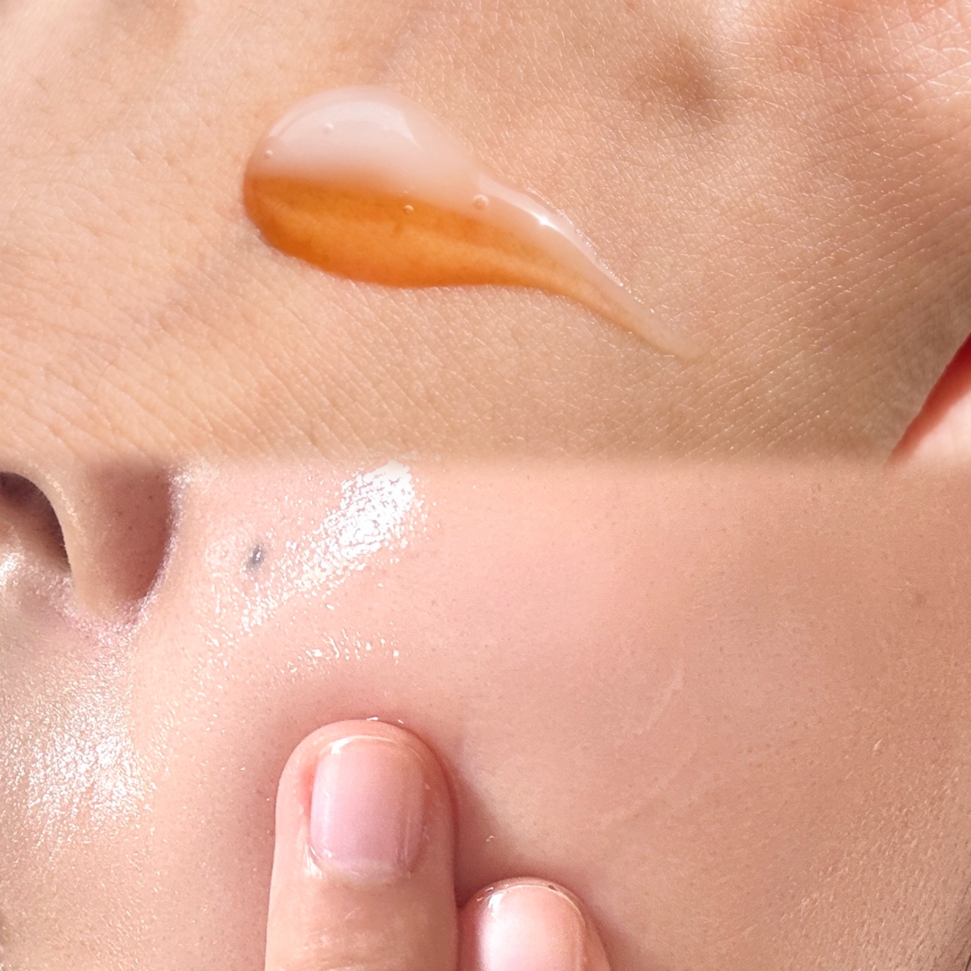 ニードルデュアルセラム/NOWL/美容液を使ったクチコミ（2枚目）