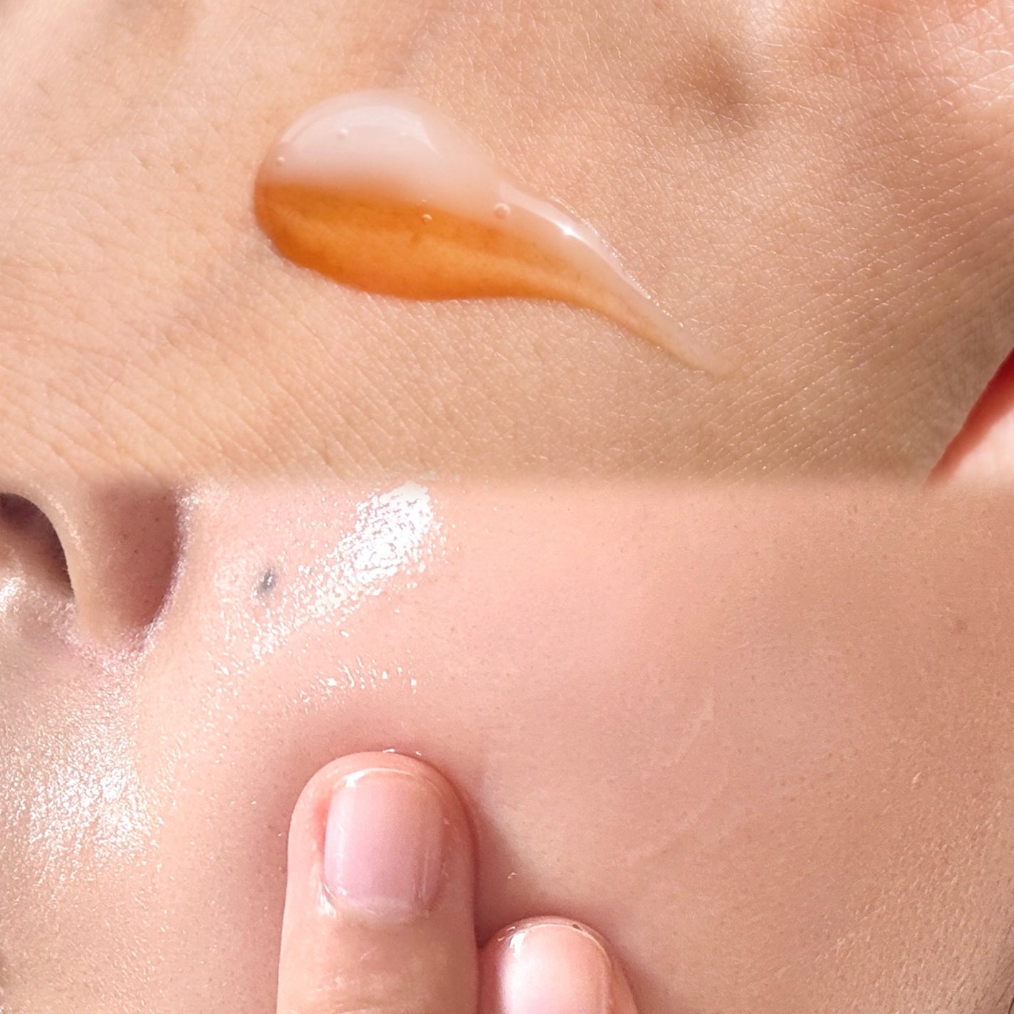 ニードルデュアルセラム/NOWL/美容液を使ったクチコミ(2枚目)