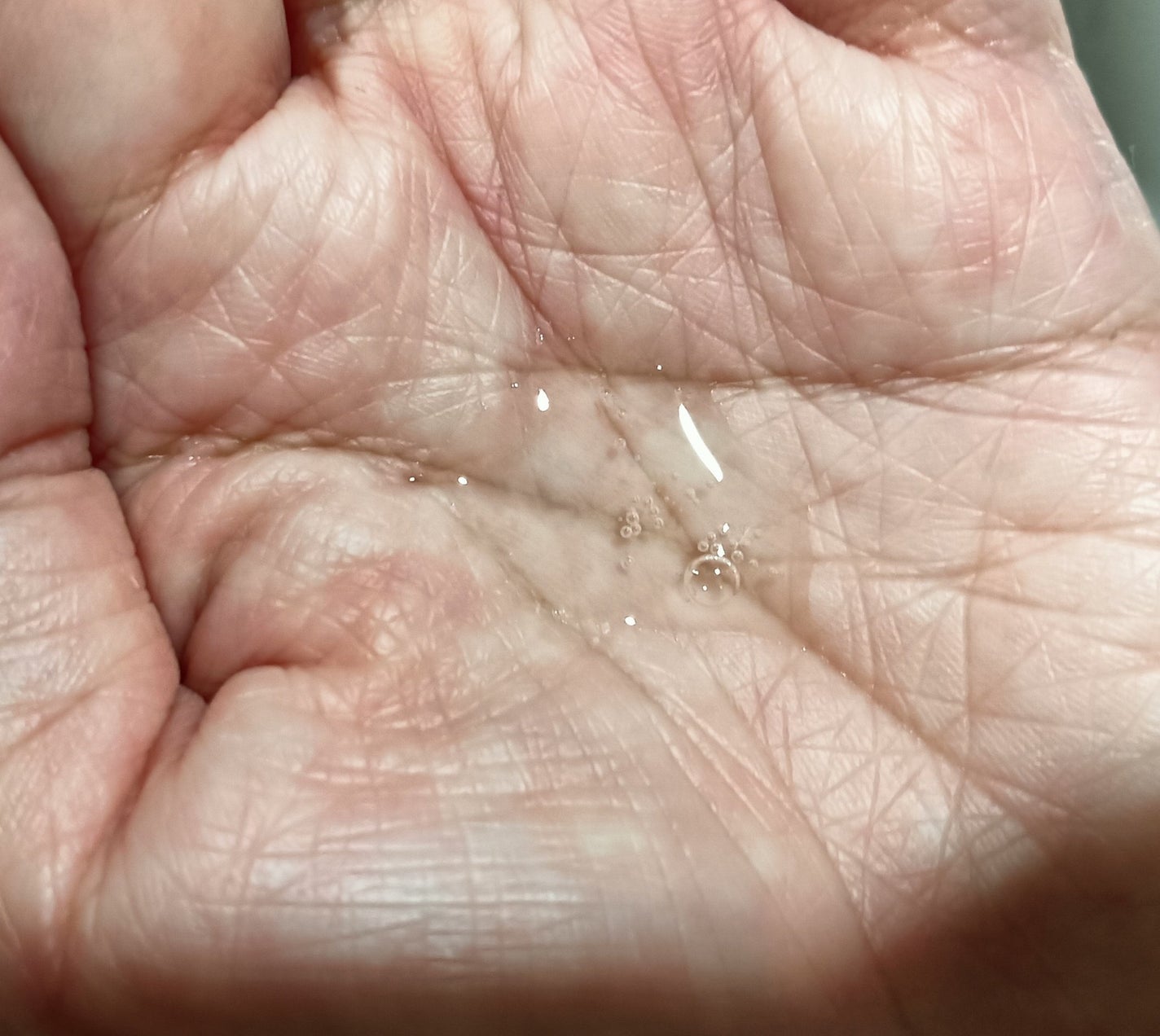 ノスカナイン トラブル セラム/FATION/美容液を使ったクチコミ(2枚目)