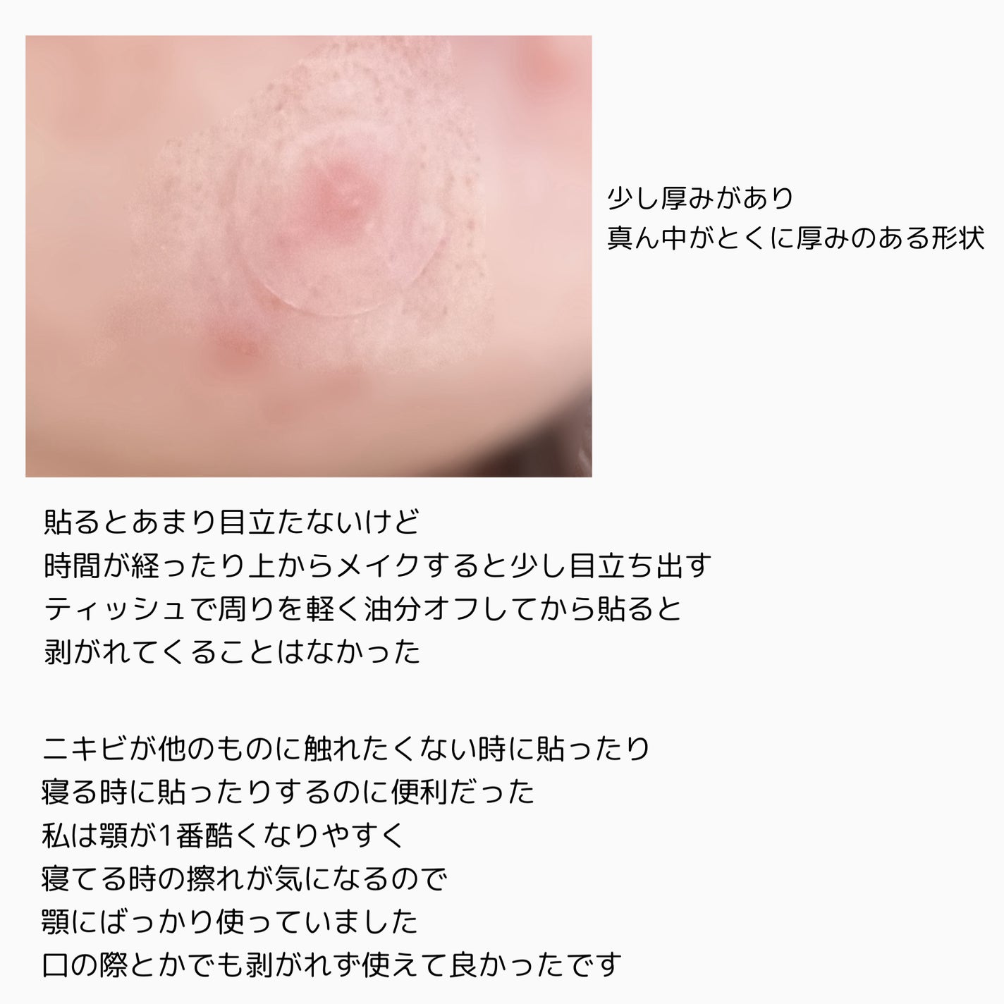 プロCICA クリアスポットパッチ/VT/その他スキンケアを使ったクチコミ(3枚目)