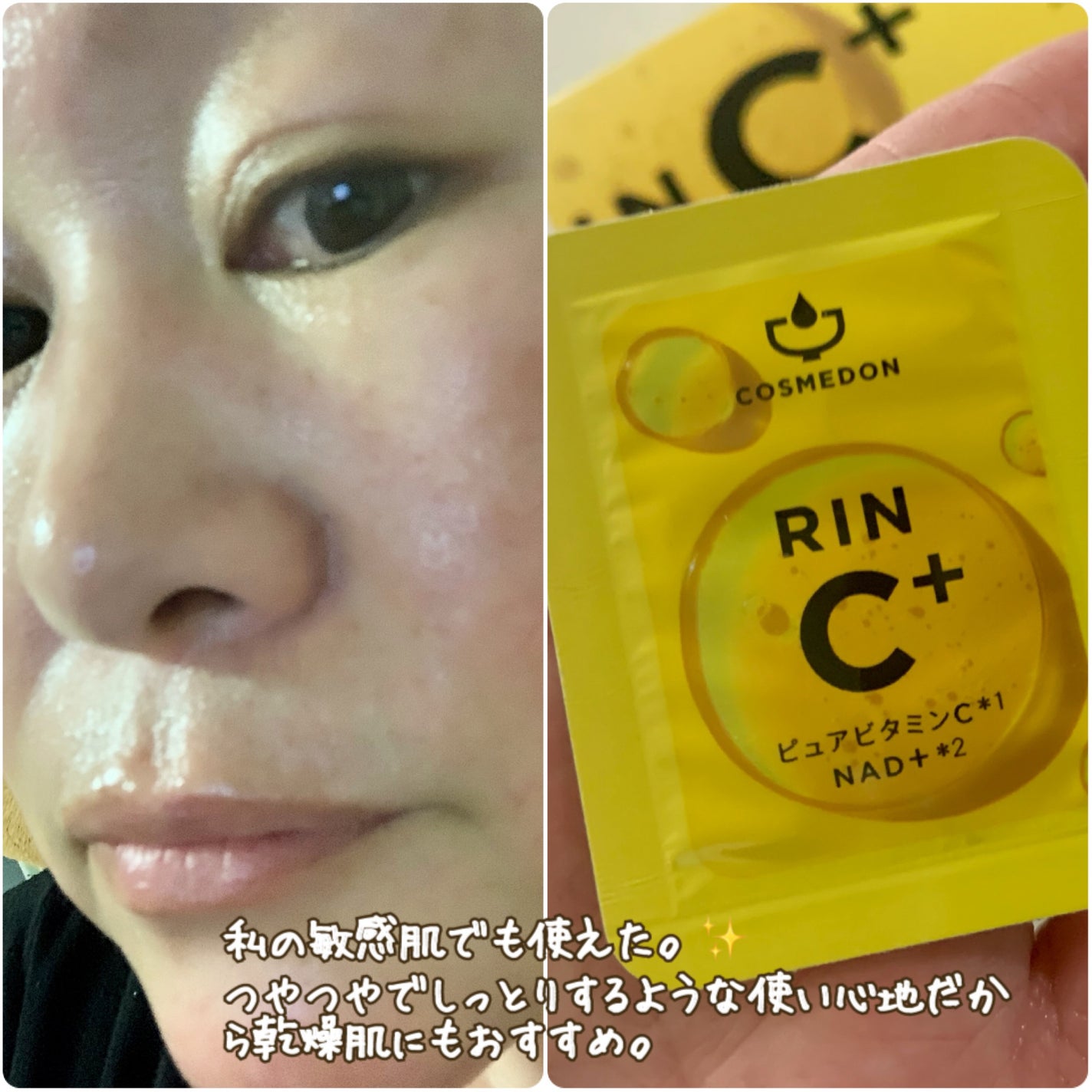 コスメドン リンシープラス/COSMEDON/美容液を使ったクチコミ(4枚目)