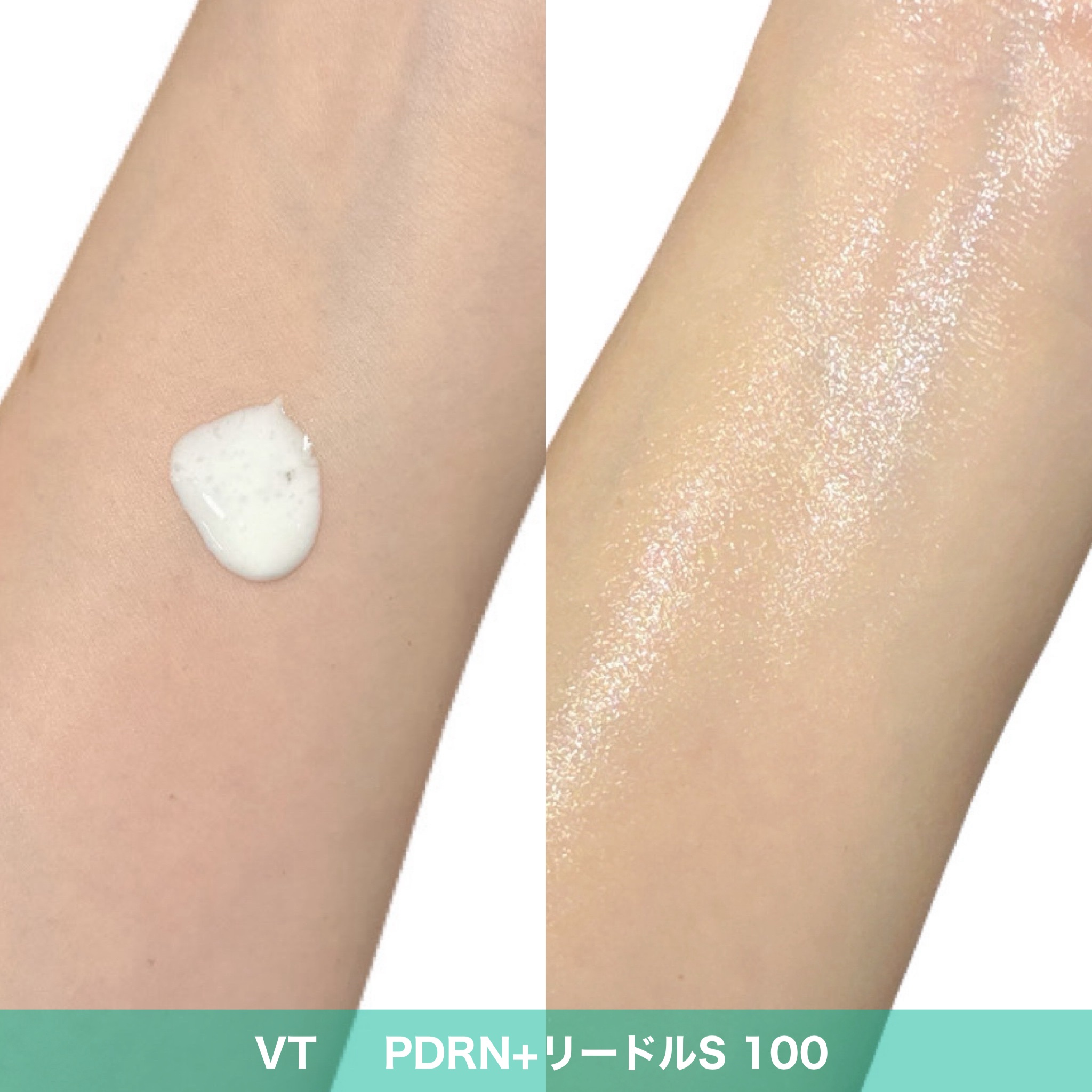 PDRN+リードルS 100/VT/美容液を使ったクチコミ（2枚目）