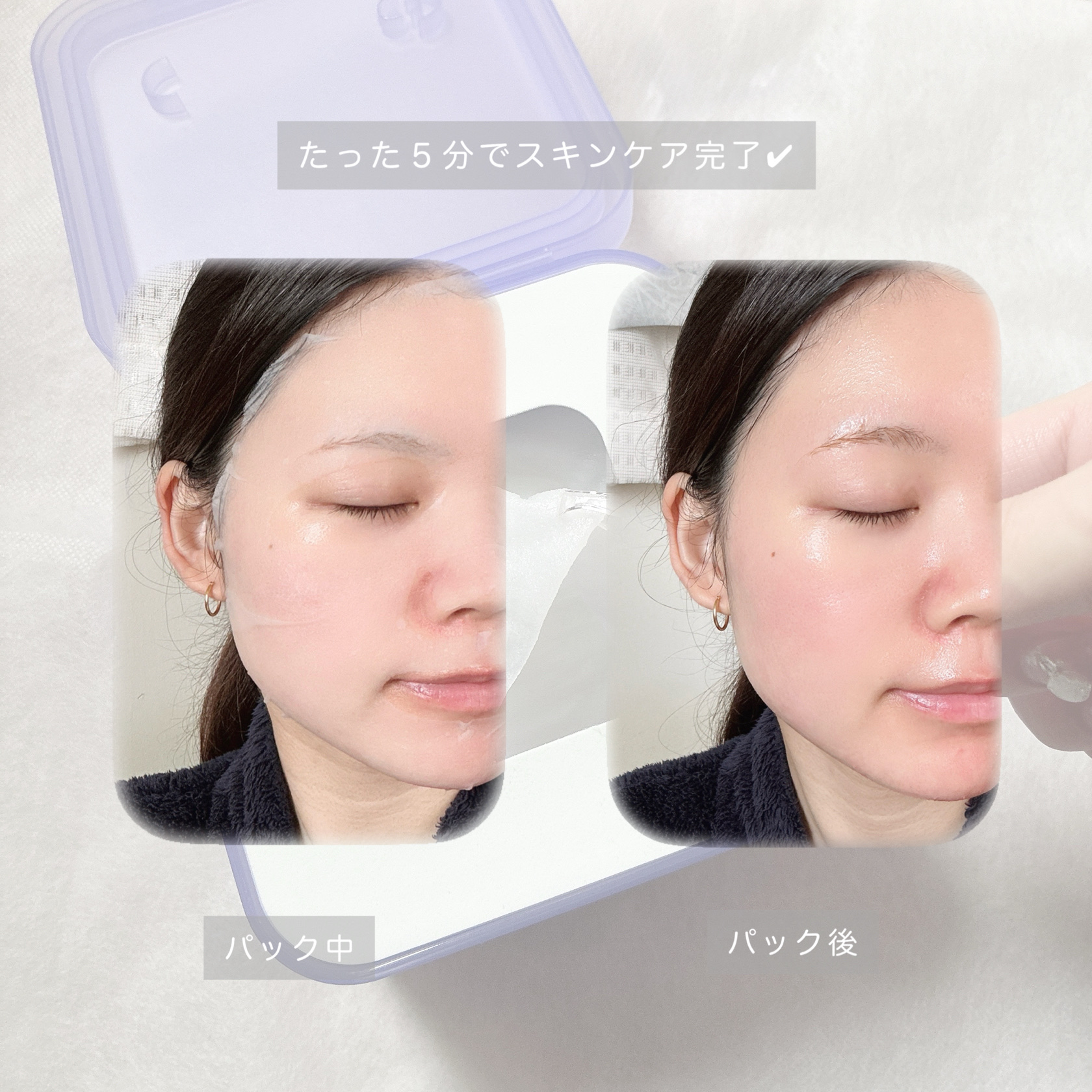 PDRN リフティングマスク/MEDIHEAL/シートマスク・パックを使ったクチコミ（3枚目）