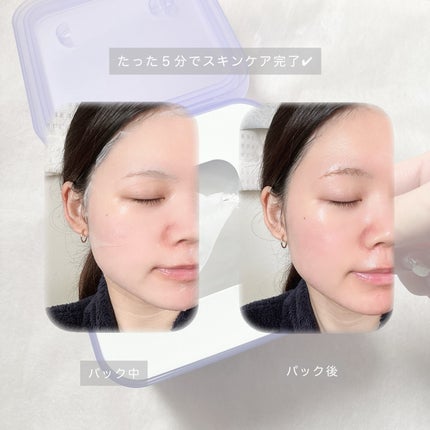 PDRN リフティングマスク/MEDIHEAL/シートマスク・パックを使ったクチコミ(3枚目)