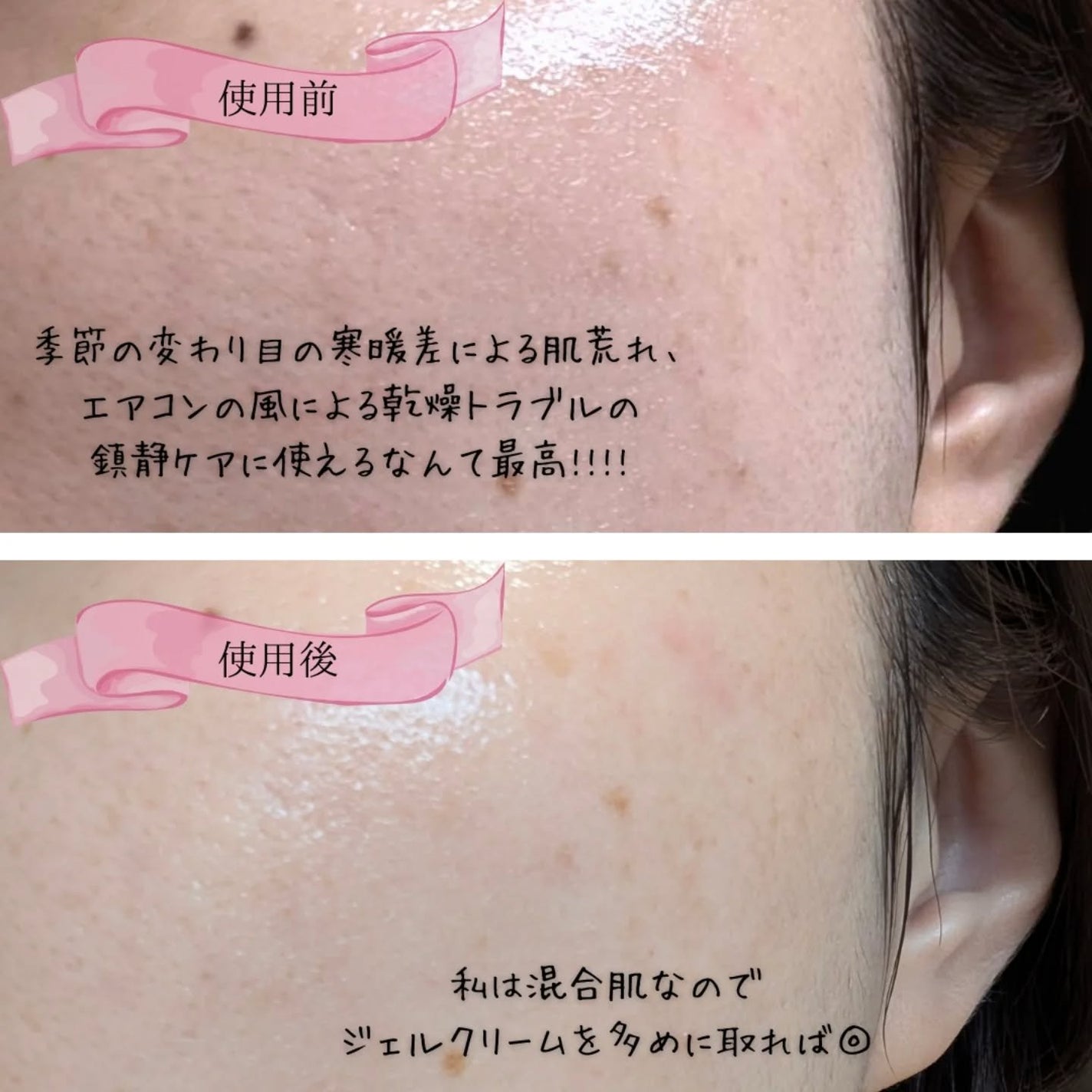 ぼんどまん on LIPS 「VTさま【PDRNカプセルクリーム PDRNリードルショット】..」(4枚目)