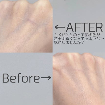 黒米フィーリングアンプル/mixsoon/美容液を使ったクチコミ(5枚目)