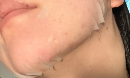 ドクダミシートマスクデイリーピック/Abib /シートマスク・パックを使ったクチコミ(3枚目)