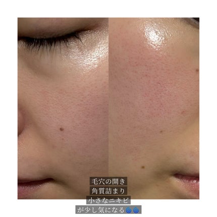 レッドブレミッシュ クリアモイスチャークリーム/Dr.G/フェイスクリームを使ったクチコミ(3枚目)